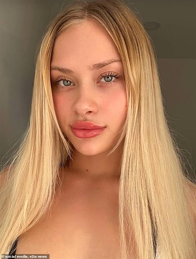 Maria Kovalchuk Survives Severe Injuries from Dubai Fall, Begins Recovery in Norway