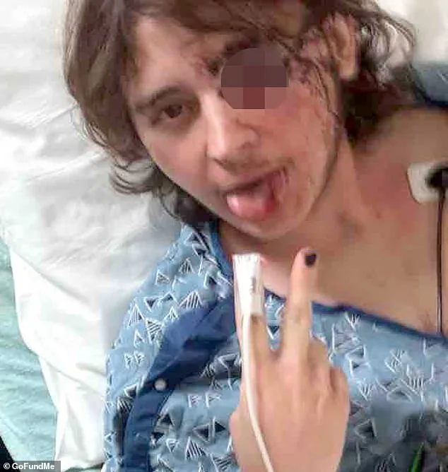 Southern California ICE Protest Confrontation Leaves Student Blind, Sparks Accountability Calls