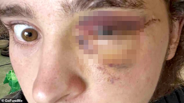 Southern California ICE Protest Confrontation Leaves Student Blind, Sparks Accountability Calls