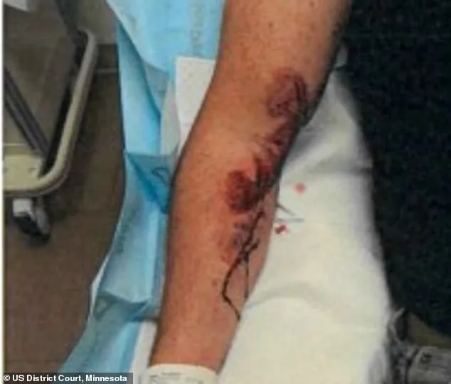 Illegal Immigrant Admits to Dragging ICE Officer Over 360 Feet, FBI Testifies Incident Could Have Been Life-Threatening
