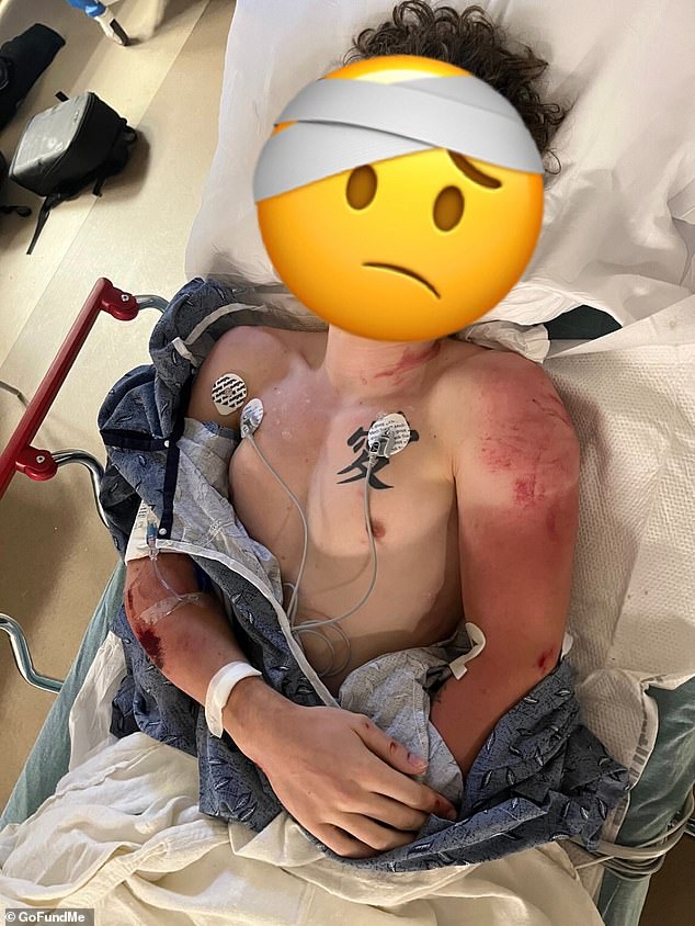 Georgia Motorcyclist Suffers Critical Injuries During Rain-Slicked Highway Chase with Police