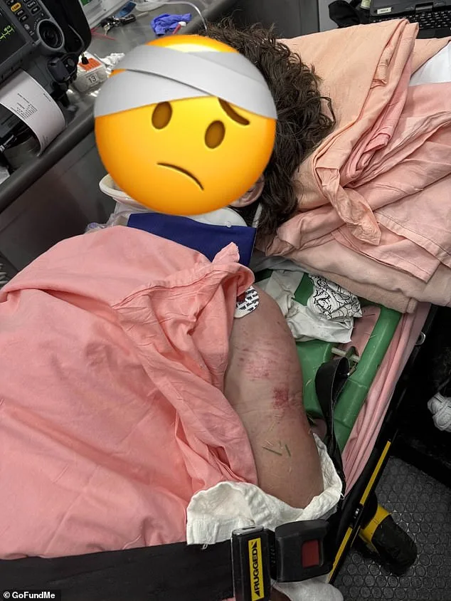 Georgia Motorcyclist Suffers Critical Injuries During Rain-Slicked Highway Chase with Police