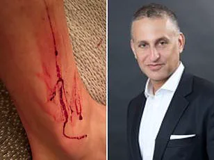 Video Shows Wealthy Banker Pulled to Ground by Mob in Brooklyn