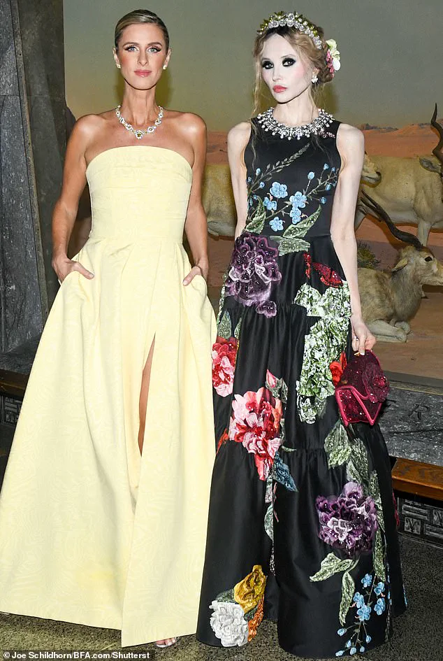 Nicky Hilton: A World of Difference from Her Famous Sister