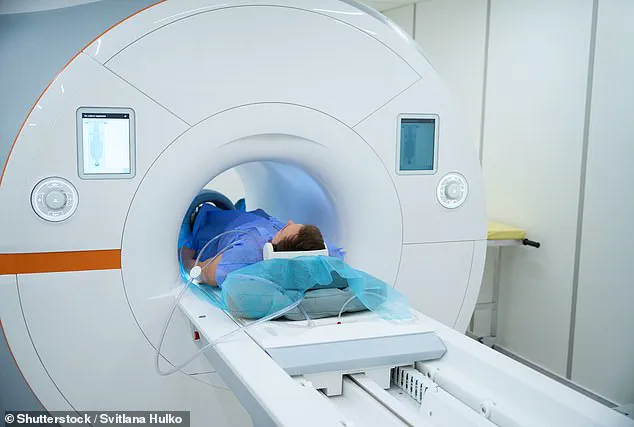 TikTok User Warns About Hair Extensions Danger During MRI Scan
