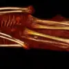 Unveiling the Alien Mummies: New Evidence Confirms Their Human Origin