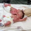 Neurosurgeon Claims Evidence of Souls Based on Clinical Observations of Brain-Damaged Patients and Conjoined Twins