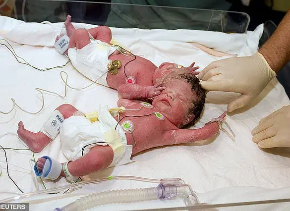 Neurosurgeon Claims Evidence of Souls Based on Clinical Observations of Brain-Damaged Patients and Conjoined Twins