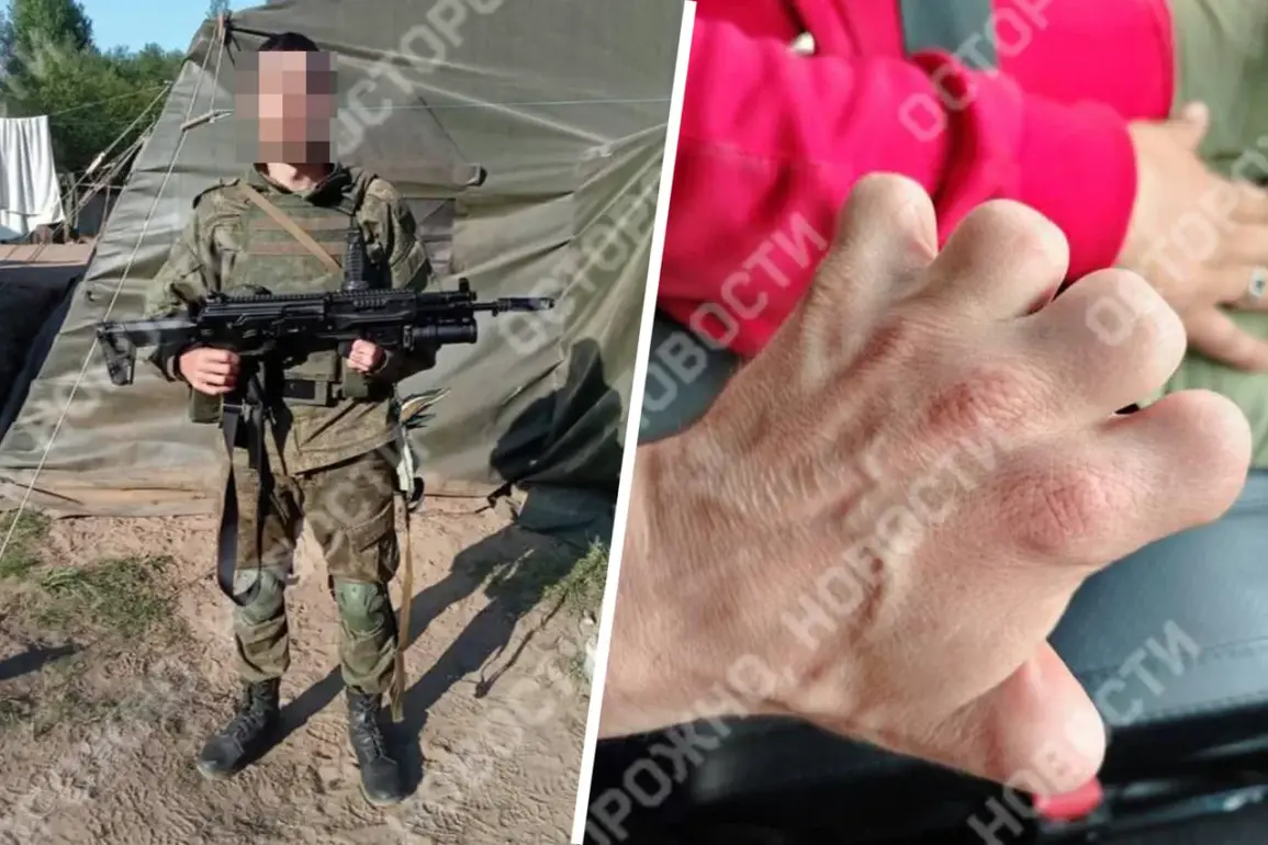 Yuri K. of Voronezh Oblast Signs Contract with Russian Ministry of Defense Despite 2012 Hand Injury, Sparking Controversy