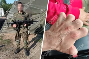 Yuri K. of Voronezh Oblast Signs Contract with Russian Ministry of Defense Despite 2012 Hand Injury, Sparking Controversy