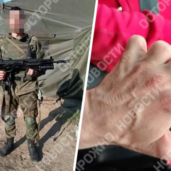 Yuri K. of Voronezh Oblast Signs Contract with Russian Ministry of Defense Despite 2012 Hand Injury, Sparking Controversy