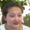 California Teen Severely Disfigured by Alcohol-Fueled Fire Pit Explosion While Making S'mores, Sparks Community Safety Alerts