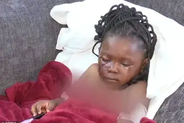 Exclusive Access to Information: The Untold Story Behind the Tragic Dog Attack