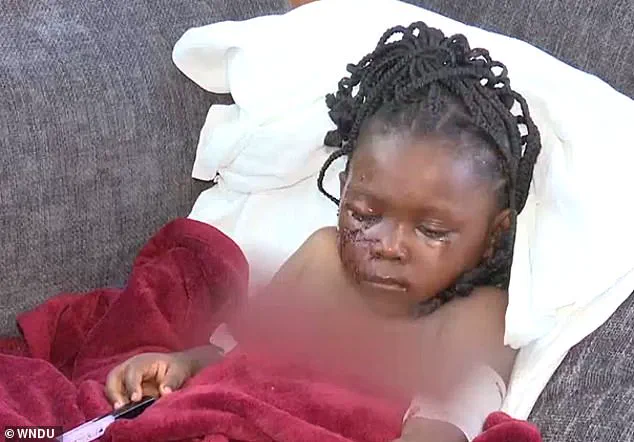 Exclusive Access to Information: The Untold Story Behind the Tragic Dog Attack