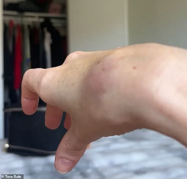 Breaking: TikTok Influencer with EDS Alleges Refusal of Assistance by American Airlines During Flight